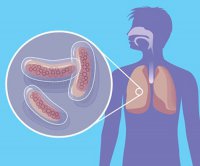 Что мы знаем о туберкулезе?